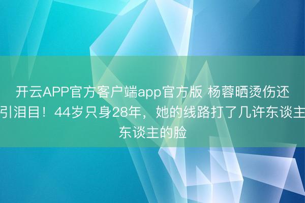 开云APP官方客户端app官方版 杨蓉晒烫伤还原照引泪目!44岁只身28年,她的线路打了几许东谈主的脸